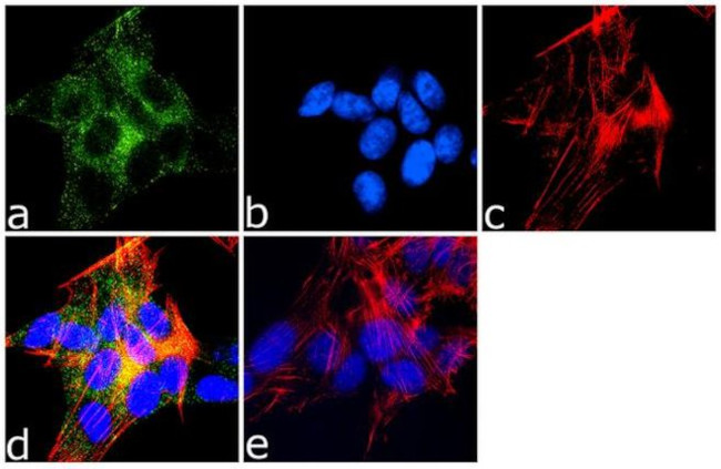 MAP2 Antibody in Immunocytochemistry (ICC/IF)