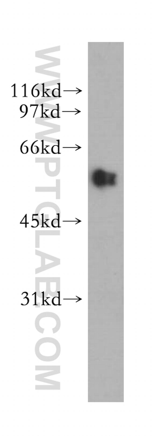 UGDH Antibody in Western Blot (WB)