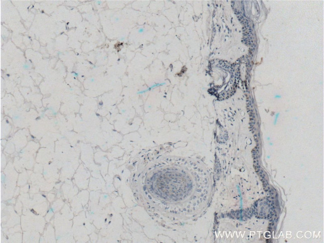 ST3GAL6 Antibody in Immunohistochemistry (Paraffin) (IHC (P))