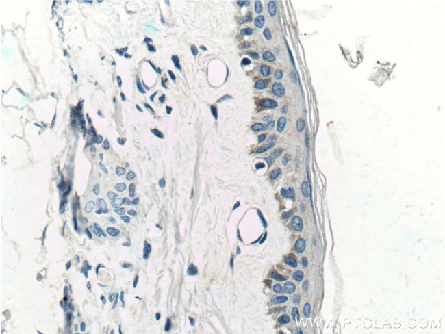 ST3GAL6 Antibody in Immunohistochemistry (Paraffin) (IHC (P))