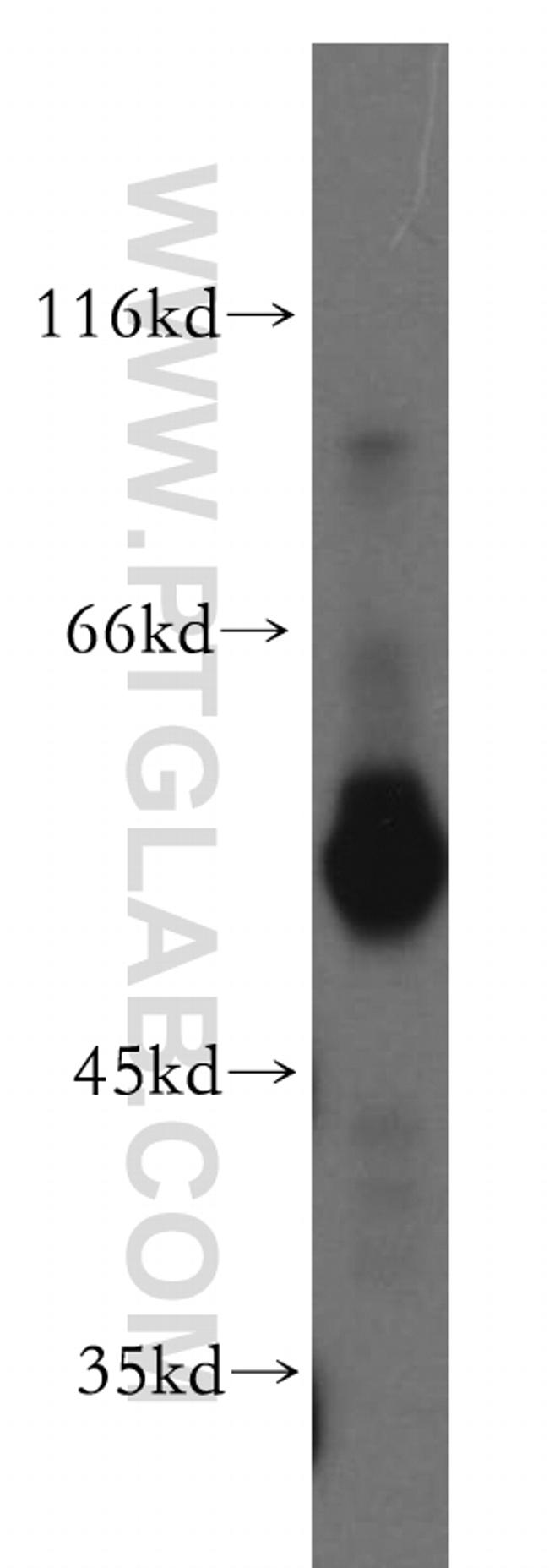 ST3GAL6 Antibody in Western Blot (WB)