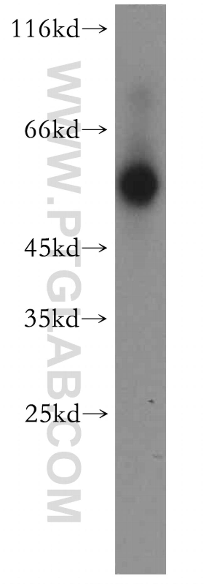 ST3GAL6 Antibody in Western Blot (WB)