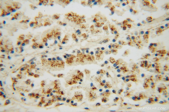 DHX36 Antibody in Immunohistochemistry (Paraffin) (IHC (P))