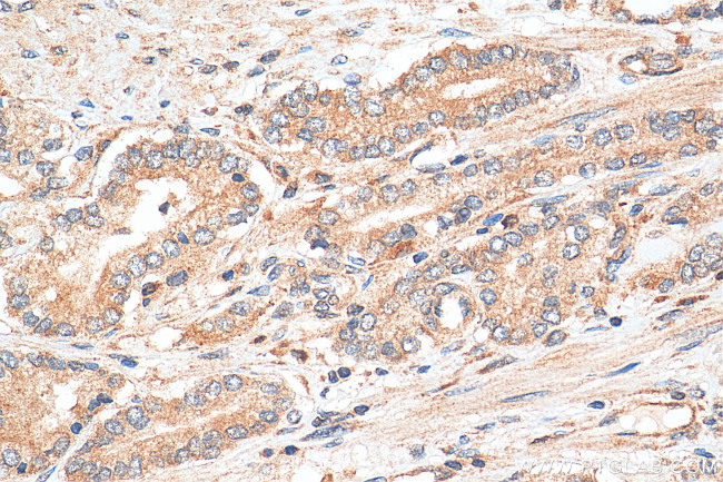 DHX36 Antibody in Immunohistochemistry (Paraffin) (IHC (P))