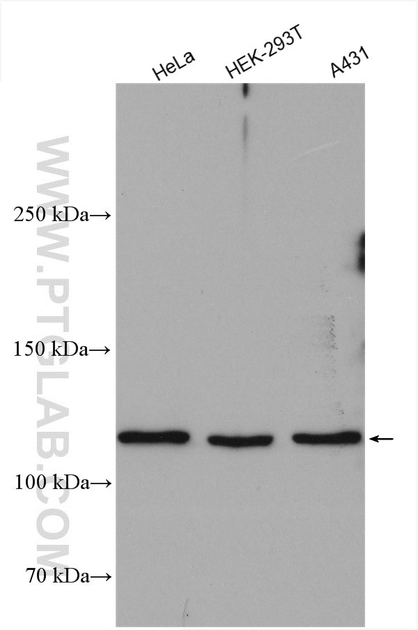 DHX36 Antibody in Western Blot (WB)