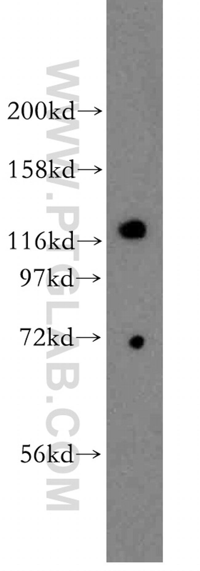 DHX36 Antibody in Western Blot (WB)