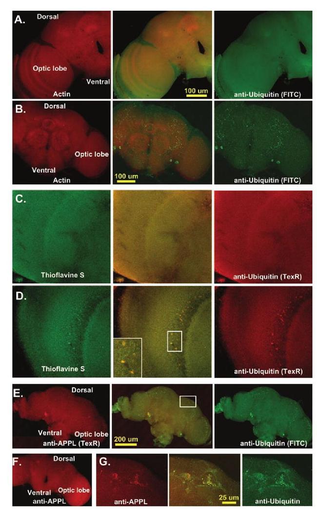 Ubiquitin Antibody in Immunohistochemistry (IHC)