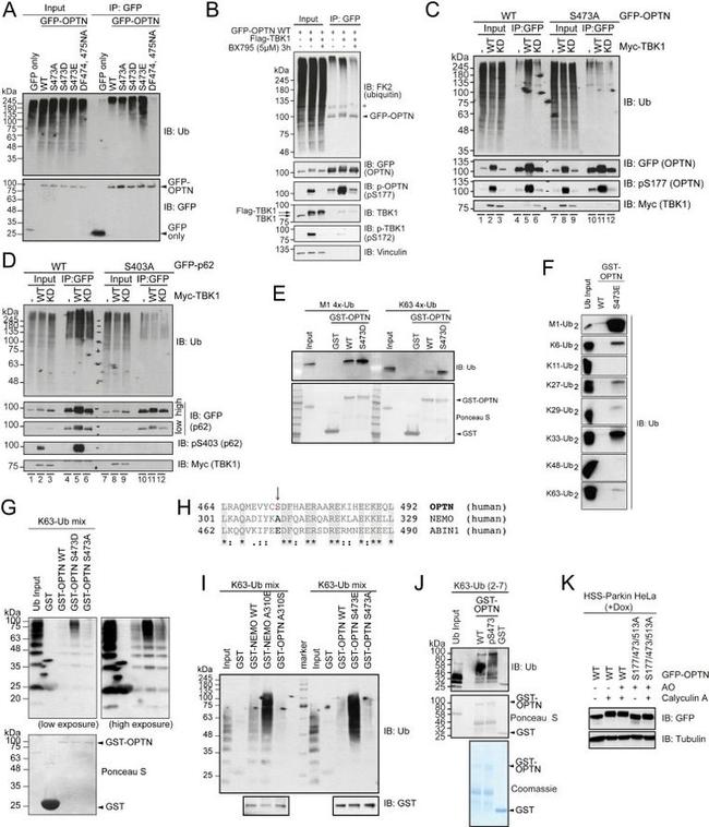 Ubiquitin Antibody in Western Blot (WB)