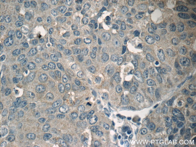 SIRT1 Antibody in Immunohistochemistry (Paraffin) (IHC (P))