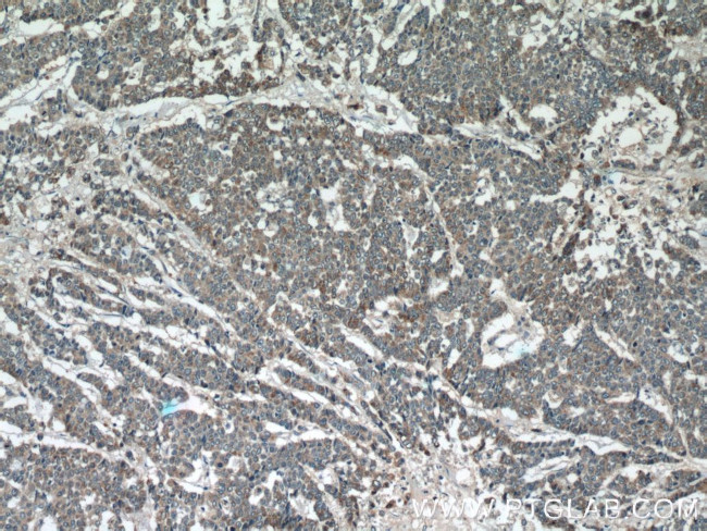 SIRT1 Antibody in Immunohistochemistry (Paraffin) (IHC (P))