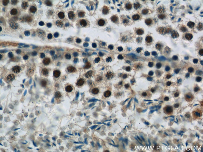 SIRT1 Antibody in Immunohistochemistry (Paraffin) (IHC (P))