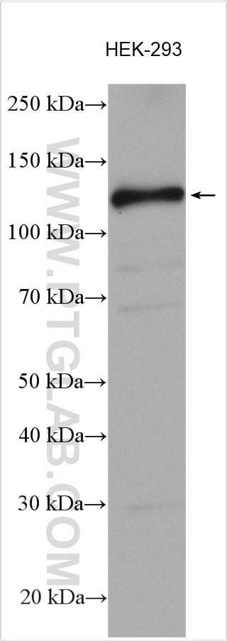 SIRT1 Antibody in Western Blot (WB)