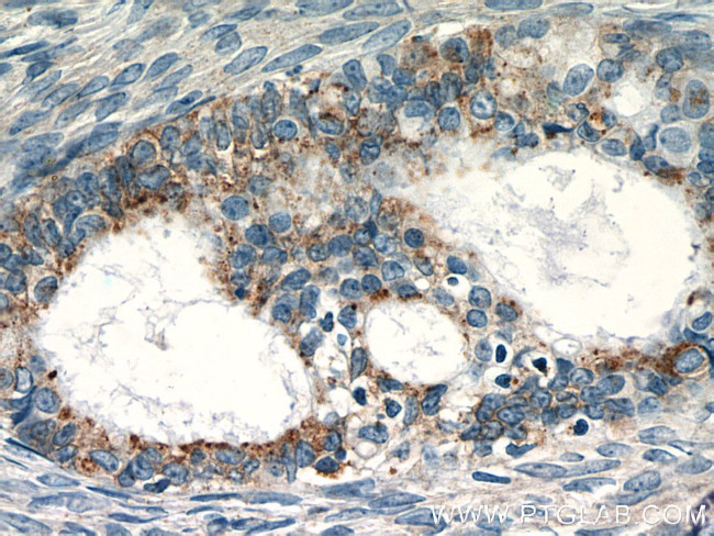 RASGRP3 Antibody in Immunohistochemistry (Paraffin) (IHC (P))