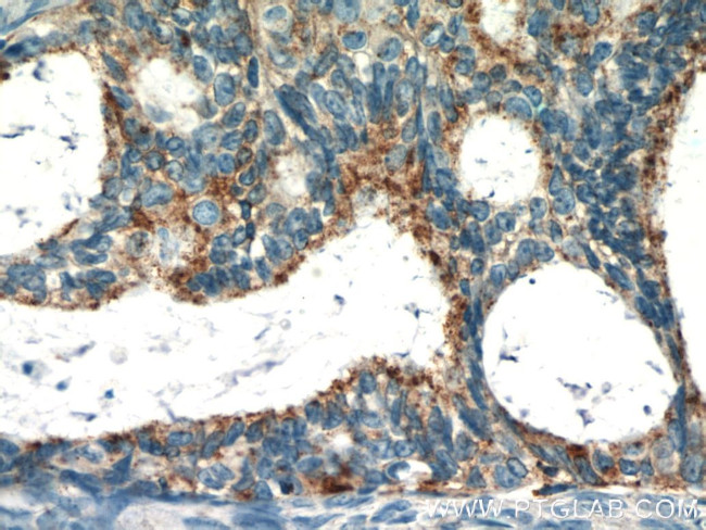 RASGRP3 Antibody in Immunohistochemistry (Paraffin) (IHC (P))