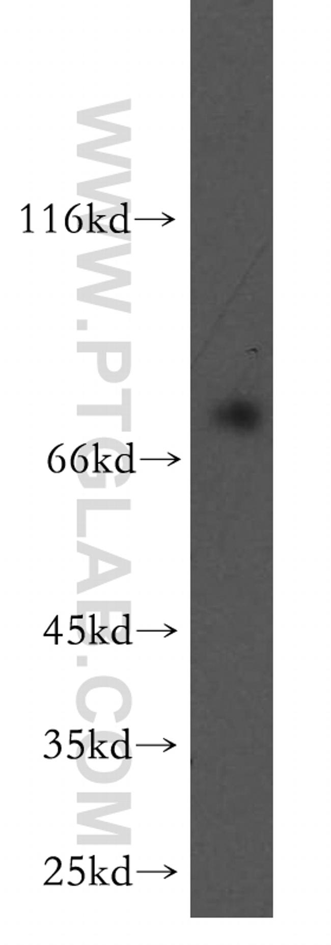 RASGRP3 Antibody in Western Blot (WB)