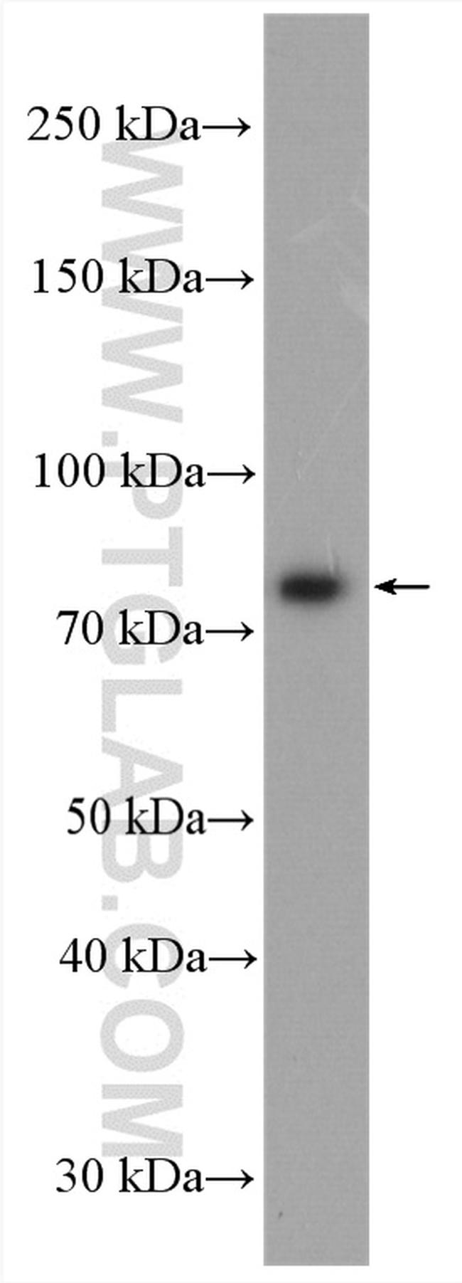 RASGRP3 Antibody in Western Blot (WB)