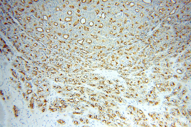 PSMA/GCPII Antibody in Immunohistochemistry (Paraffin) (IHC (P))