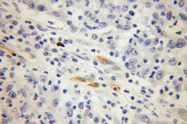 PSMA/GCPII Antibody in Immunohistochemistry (Paraffin) (IHC (P))