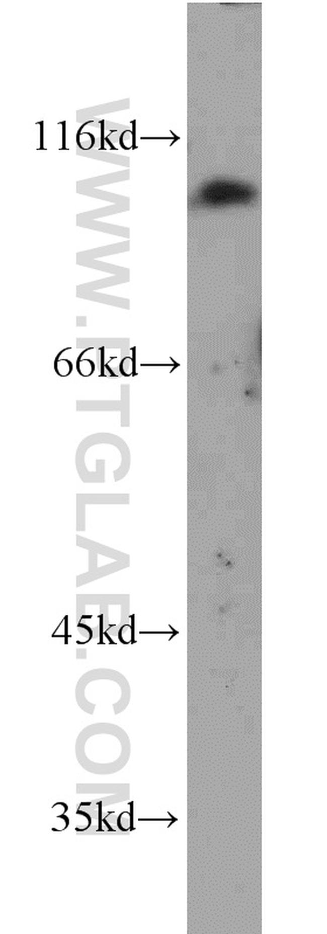 PSMA/GCPII Antibody in Western Blot (WB)