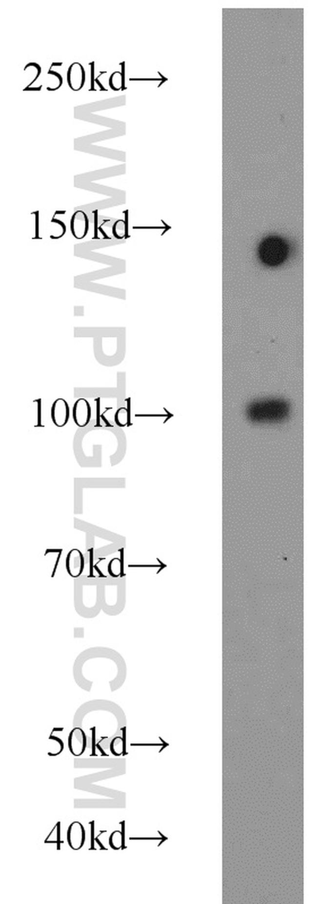 PSMA/GCPII Antibody in Western Blot (WB)