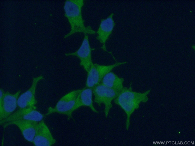 PSMA/GCPII Antibody in Immunocytochemistry (ICC/IF)