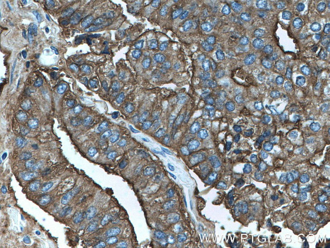 PSMA/GCPII Antibody in Immunohistochemistry (Paraffin) (IHC (P))