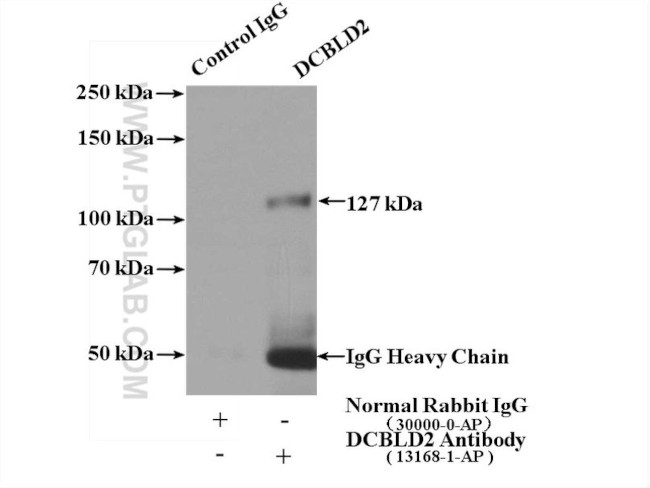 DCBLD2 Antibody in Immunoprecipitation (IP)