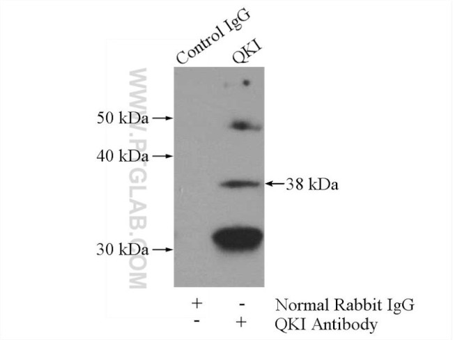 QKI Antibody in Immunoprecipitation (IP)