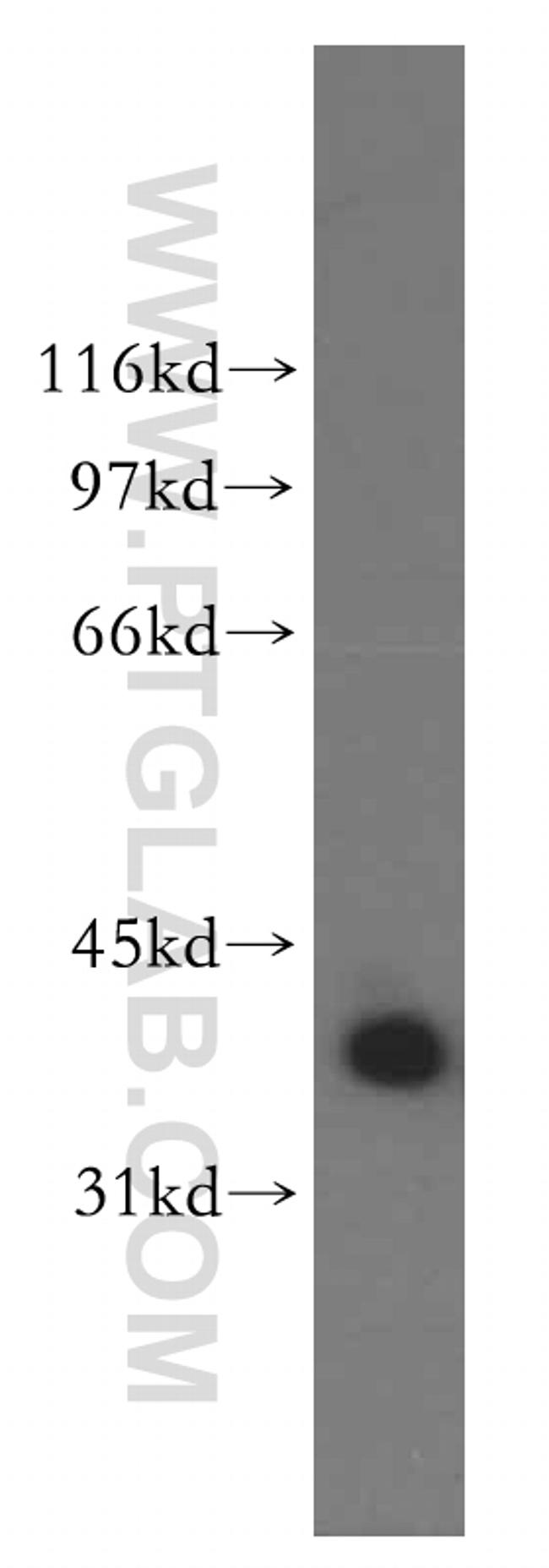 QKI Antibody in Western Blot (WB)