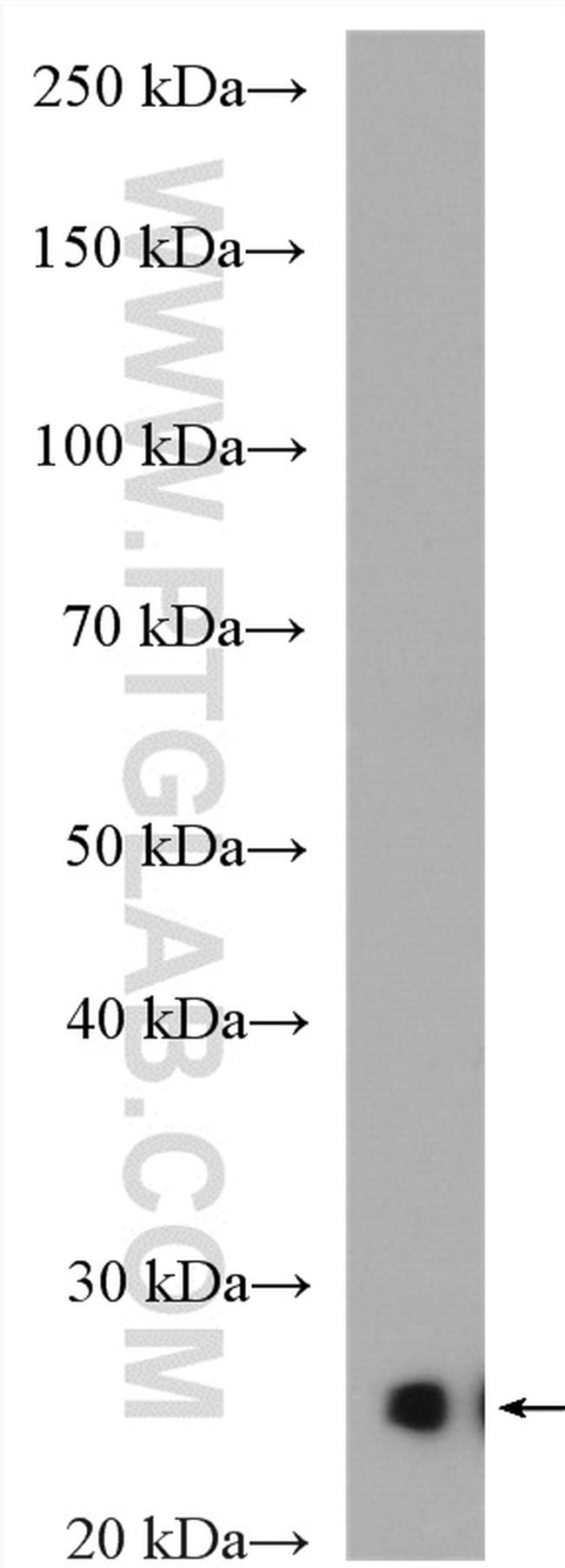 CIDEA Antibody in Western Blot (WB)