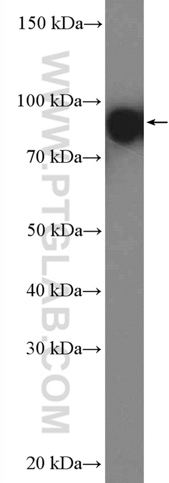 HSP90 Antibody in Western Blot (WB)