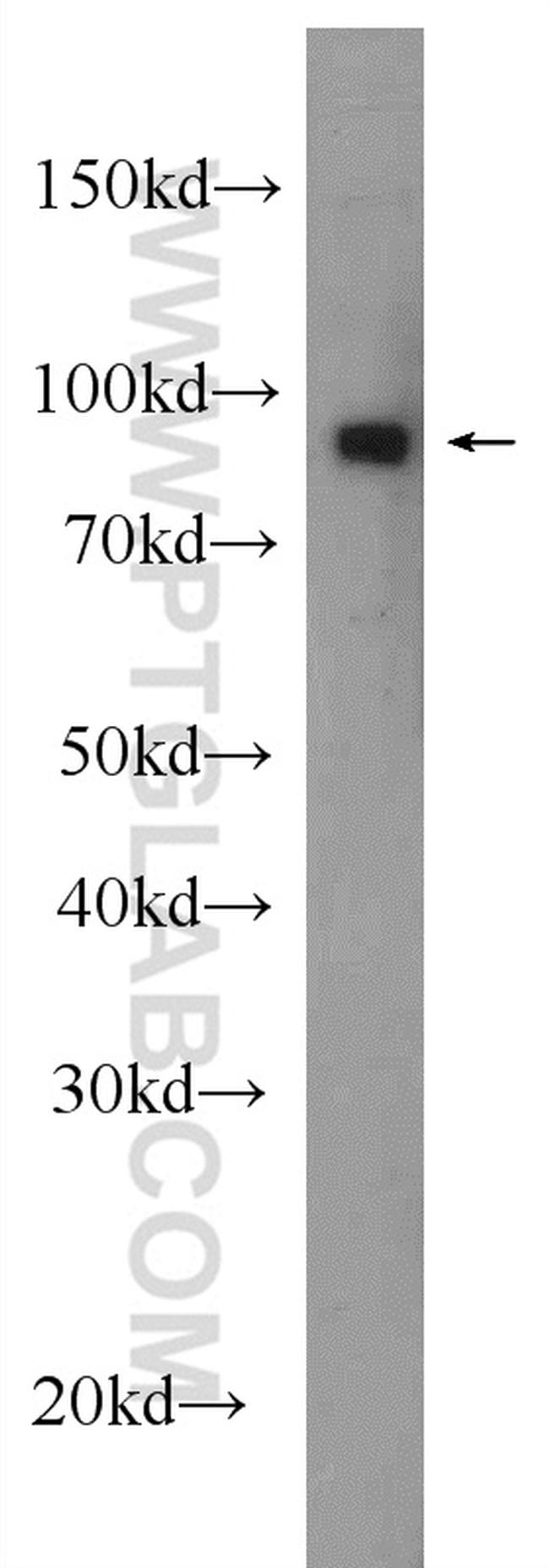 HSP90 Antibody in Western Blot (WB)