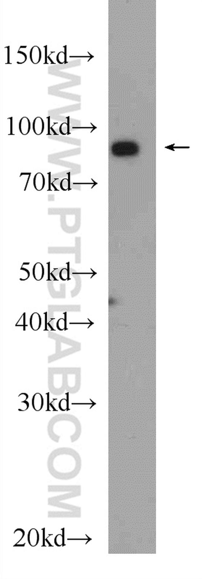 HSP90 Antibody in Western Blot (WB)