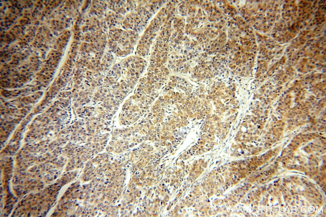 HSP90 Antibody in Immunohistochemistry (Paraffin) (IHC (P))