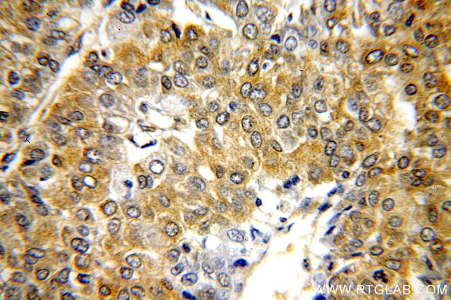 HSP90 Antibody in Immunohistochemistry (Paraffin) (IHC (P))