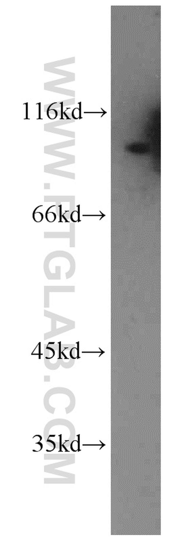 RALBP1 Antibody in Western Blot (WB)