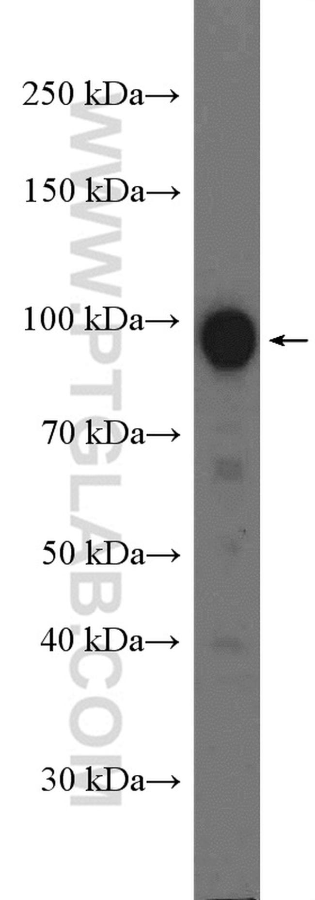 RALBP1 Antibody in Western Blot (WB)