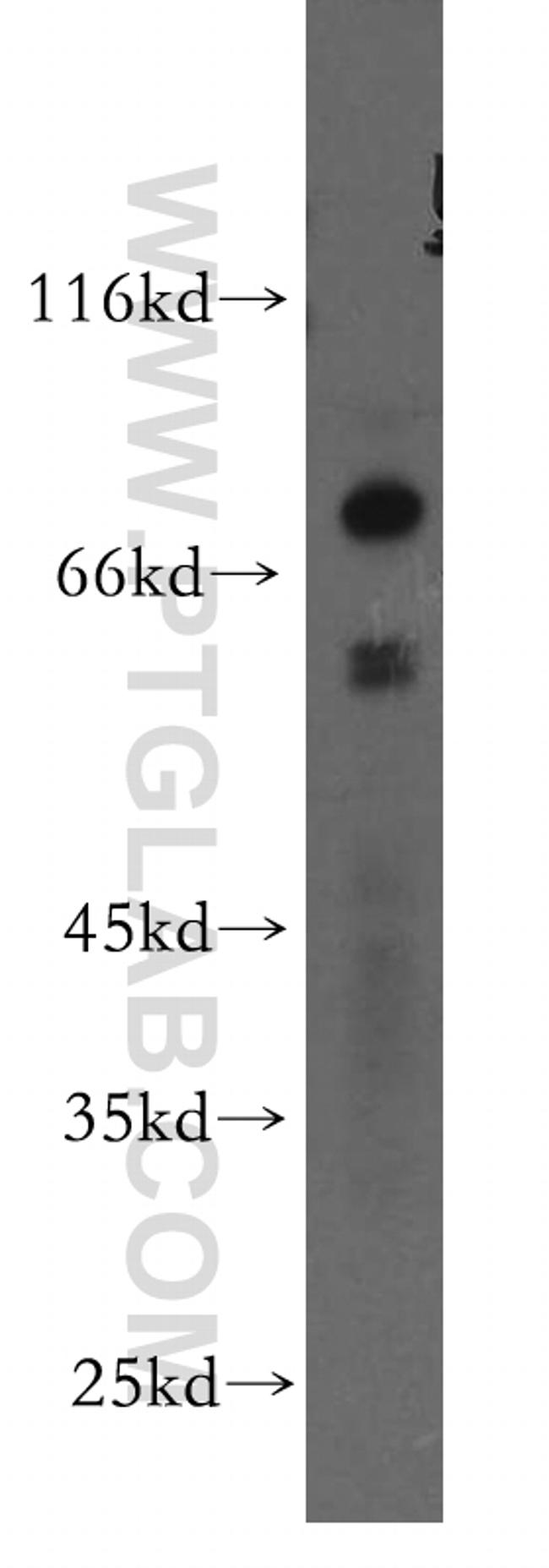 TBX5 Antibody in Western Blot (WB)