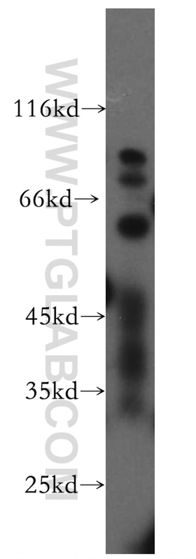 TBX5 Antibody in Western Blot (WB)