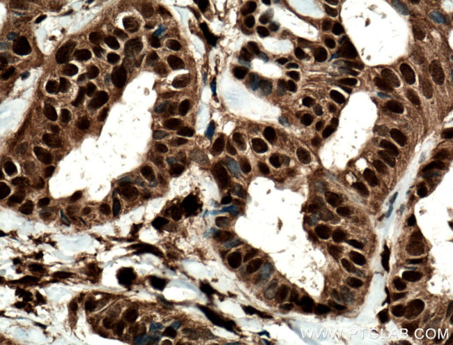 STAT5A Antibody in Immunohistochemistry (Paraffin) (IHC (P))