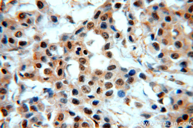 STAT5A Antibody in Immunohistochemistry (Paraffin) (IHC (P))