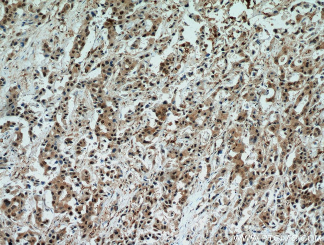 STAT5A Antibody in Immunohistochemistry (Paraffin) (IHC (P))