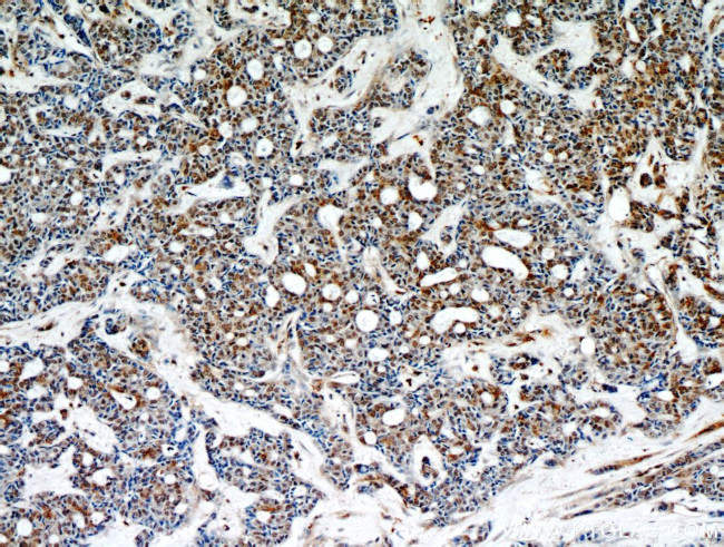 STAT5A Antibody in Immunohistochemistry (Paraffin) (IHC (P))