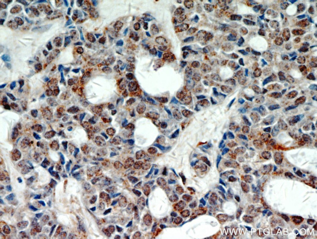 STAT5A Antibody in Immunohistochemistry (Paraffin) (IHC (P))