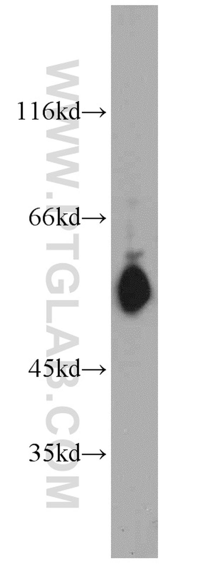 STAT5A Antibody in Western Blot (WB)