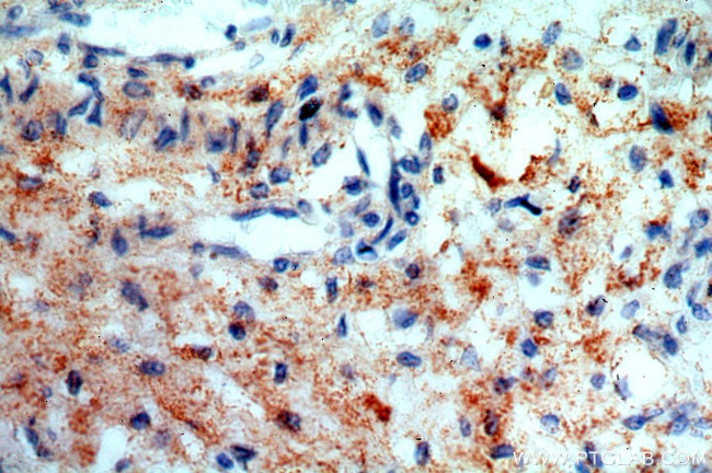 SNX20 Antibody in Immunohistochemistry (Paraffin) (IHC (P))