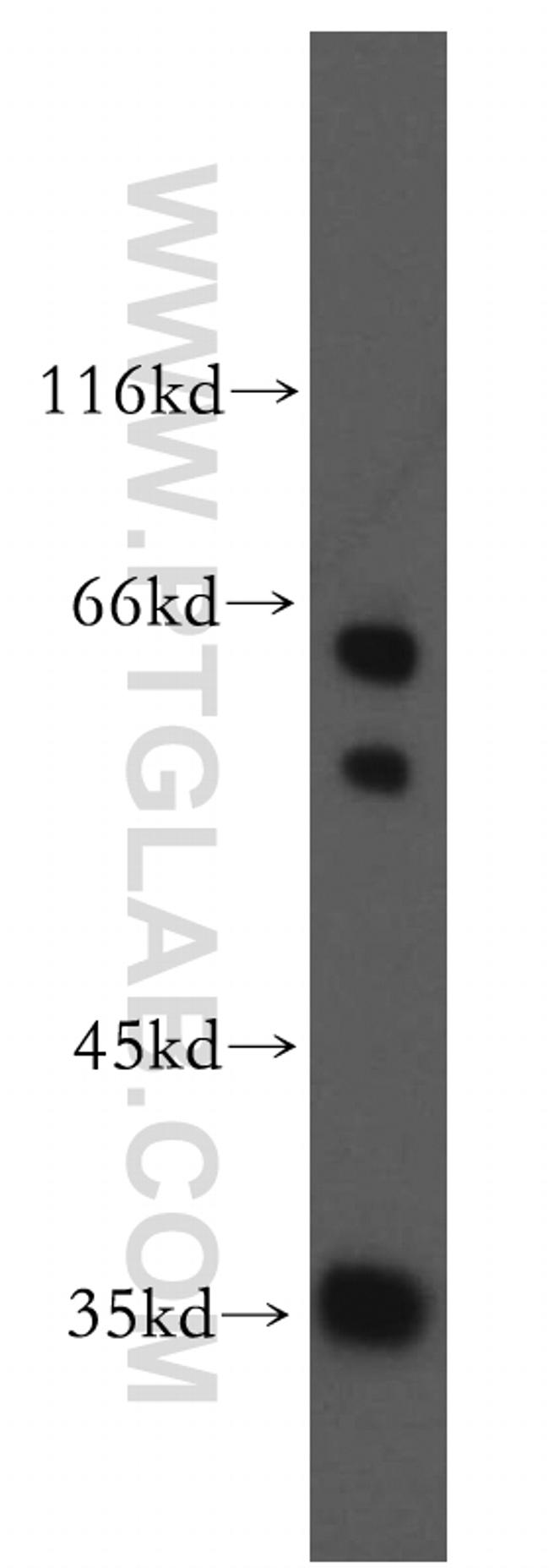 SNX20 Antibody in Western Blot (WB)