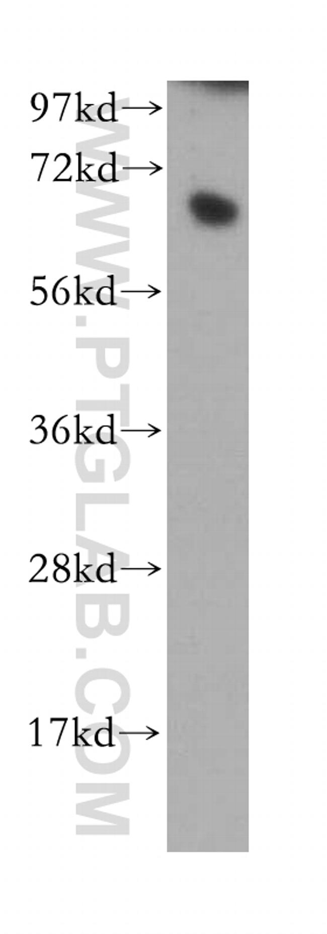 RBBP5 Antibody in Western Blot (WB)