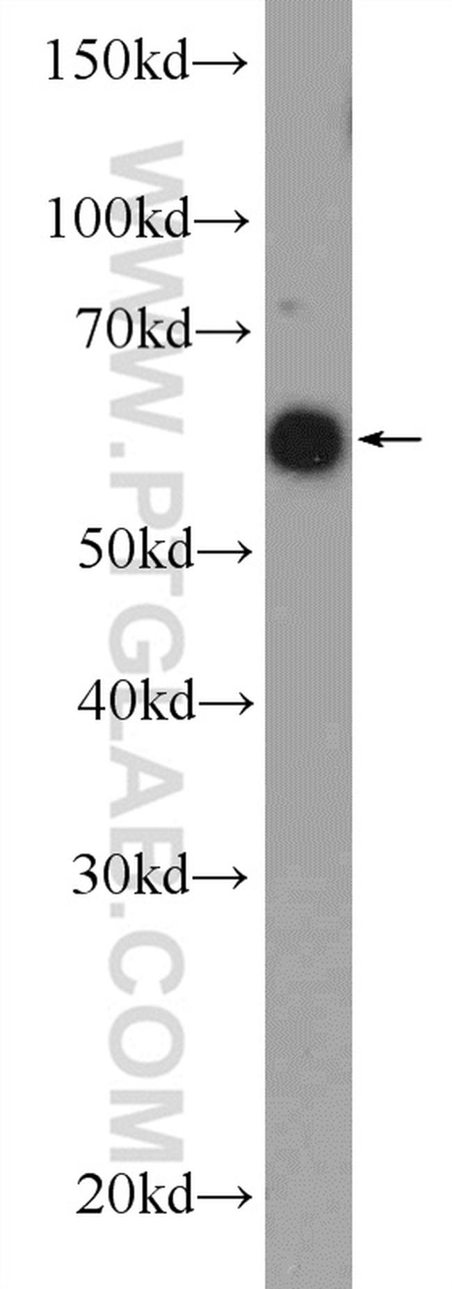 RBBP5 Antibody in Western Blot (WB)