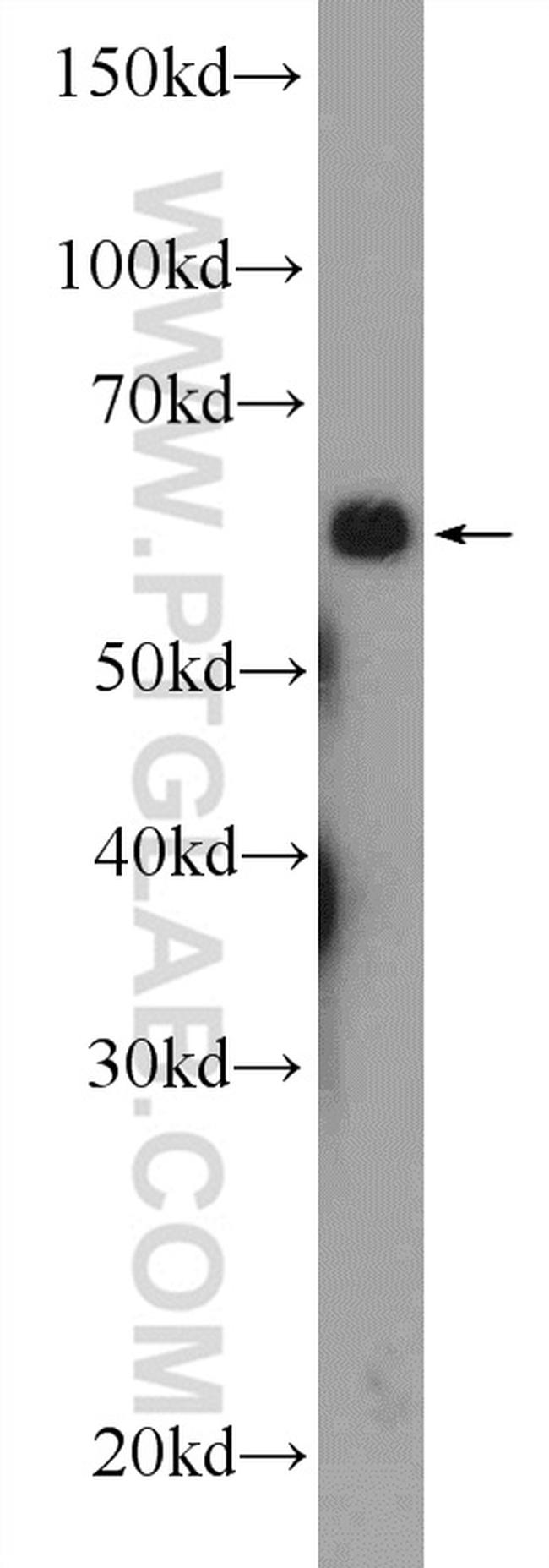 RBBP5 Antibody in Western Blot (WB)